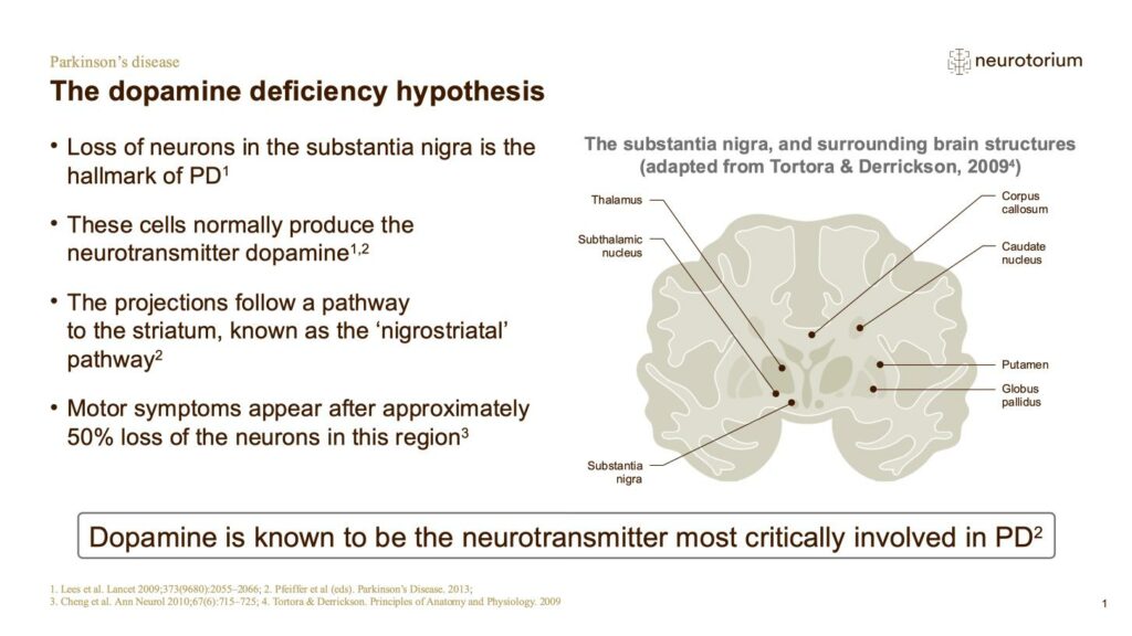 The dopamine deficiency hypothesis
